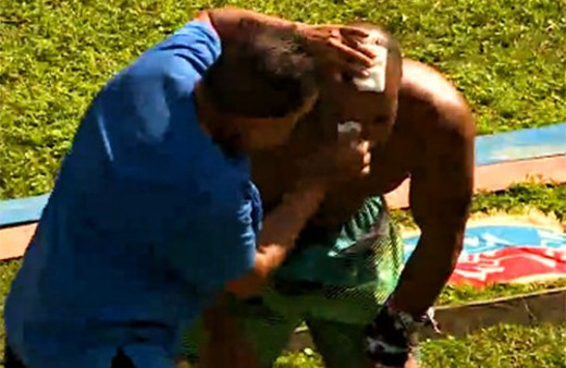 Survivor'da Gönüllü yarışmacı başından yaralandı!