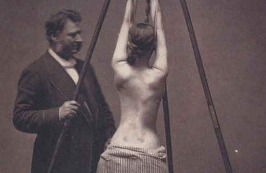 Bu nasıl tedavi yöntemi! Önce hastayı bağlayıp sonra da...