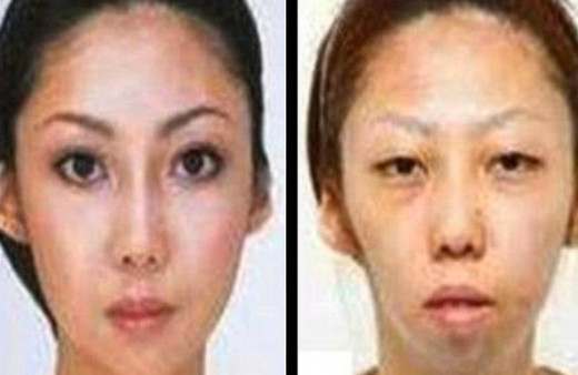 Estetik yaptıran ünlüler tanınmaz halde!