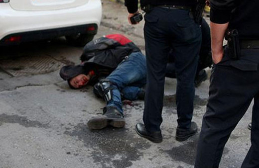 Kavgayı ayırmaya gelenleri ısırdı