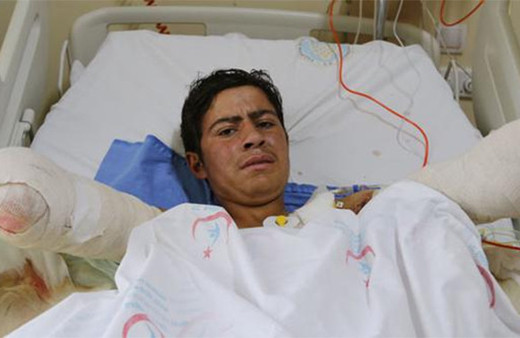 Kuşu kurtarırken ellerini kaybeden Ramazan'a iyi haber!