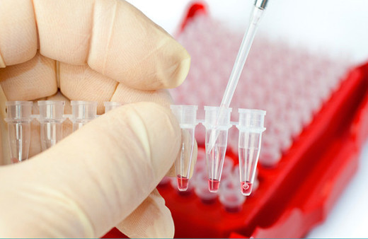 Kanser teşhisinde yapay zeka yardımı