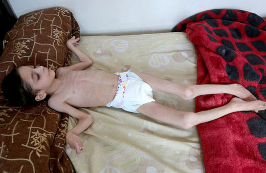 Esed zulmü tavan yaptı! Çocuklar açlıktan ölüyor!