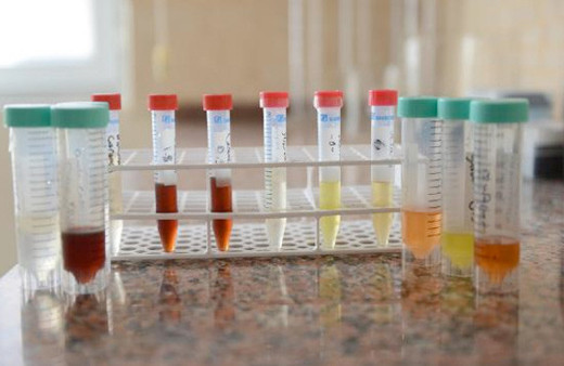 Elektronik sigarada büyük tehlike yeni hastalıklar kapıda