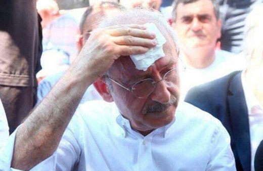 Kılıçdaroğlu'nun 4 tırnağı söküldü! Peki ama neden?