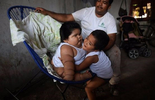 Dünyanın en şişman bebeğine doktorlar teşhis koyamadı!