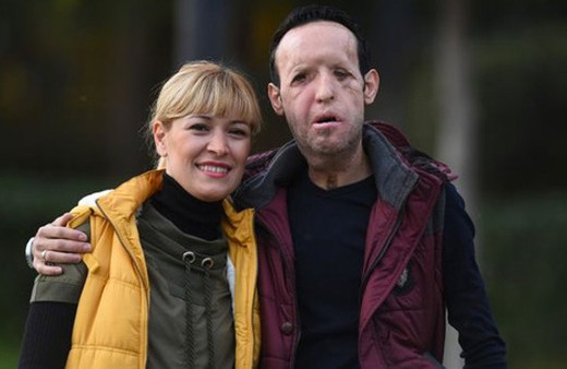 Yüz nakilli Recep Sert tutuklandı!