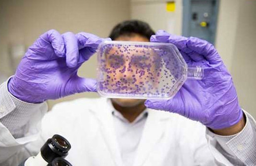 Bu buluş kanseri bitirebilir doktora öğrencisi keşfetti