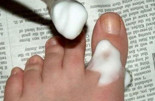 Karbonatı alın ayak parmağınıza sürün bakın neler olacak