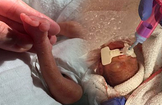 Dünya onu konuştu 'Uzaylı bebek' görenleri şoke ediyor