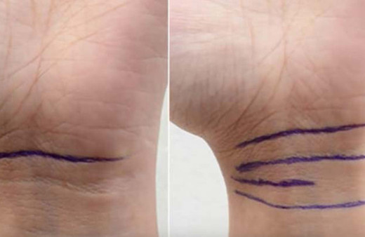 Bileğinizdeki çizgilerin anlamı ne?