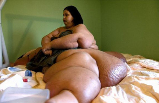 Parmağını kıpırdatamıyordu yarım ton kilo verdi değişim olay