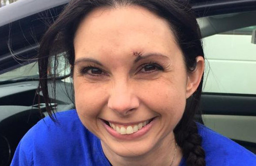 Ormanda spor yapan kadına saldırdı sonrası çok fena!