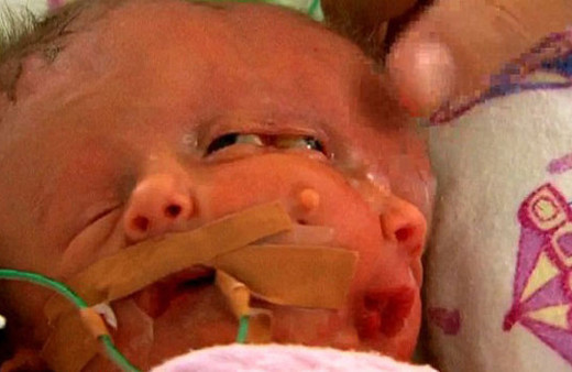 Onlar 'iki yüzlü' olarak dünyaya geldi inanması zor ama gerçek!