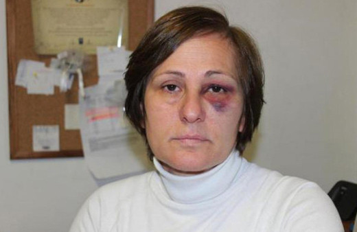 Sokak hayvanlarını besliyor diye gözünü morarttılar!