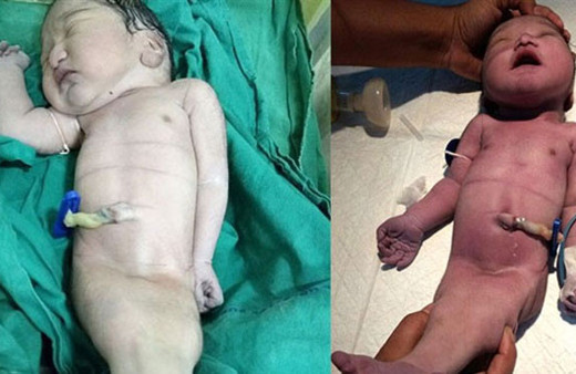 Hindistan'da doğan deniz kızı 4 saat yaşadı