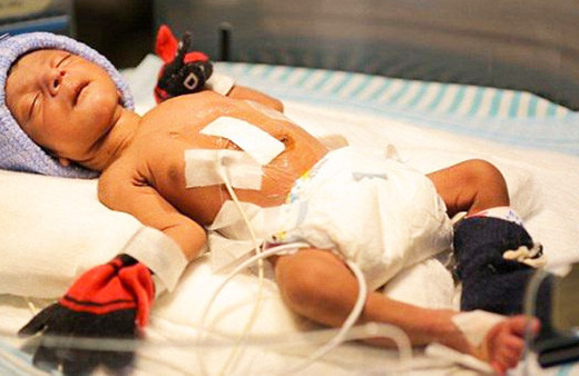 Dört ayak ve iki cinsel organla doğdu inanılmaz!