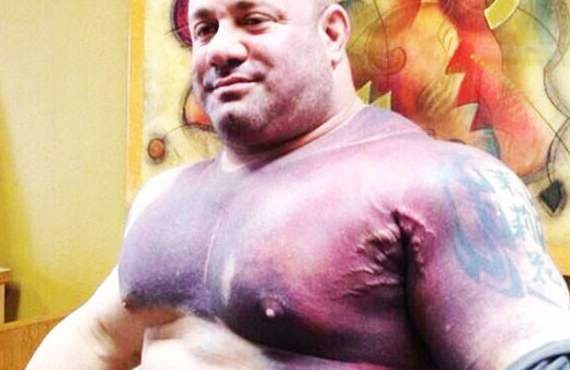 Kas yapayım derken geldiği hale bakın 