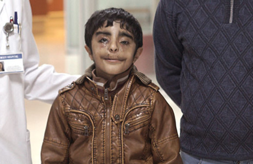 Yediği yemekler gözünden ve burnundan geliyor!