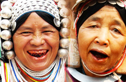 Hayatları boyunca diş macunu görmemişler inanılmaz!