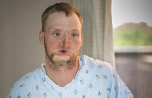 Yüzü parçalanmıştı şimdiki haline bakın