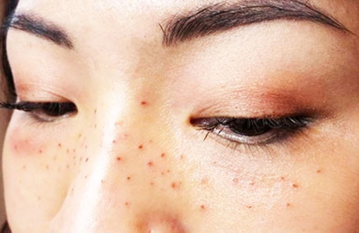 Yeni akım bu! İnsan bunu kendine neden yapar?