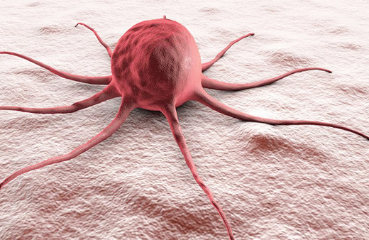 ABD'de hastanın karnından 59 kilogramlık tümör alındı