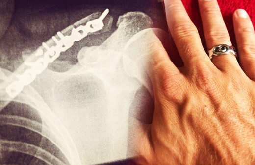 Vücudundan çıkardığı malzemeyle yüzük yaptı!