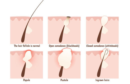 Kıl dönmesine dikkat! Sandığınızdan daha tehlikeli