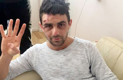 Hollanda'da köpeğin saldırdığı Kurt'tan haber var