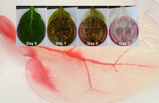 Tıpta çığır açıldı! Ispanaktan insan kalbi ürettiler