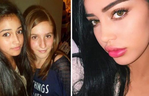 Fenomen olmak için estetik yaptırıyorlar