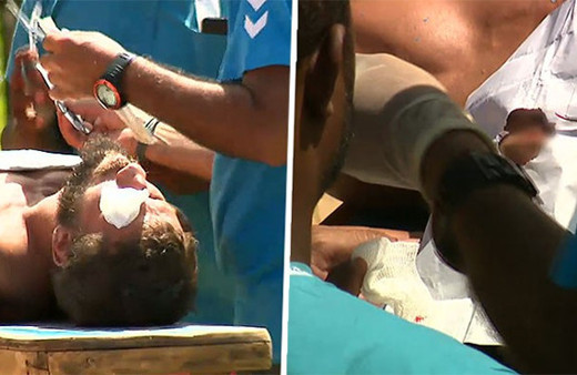 Survivor'ın ünlü ismine doktor müdahalesi!