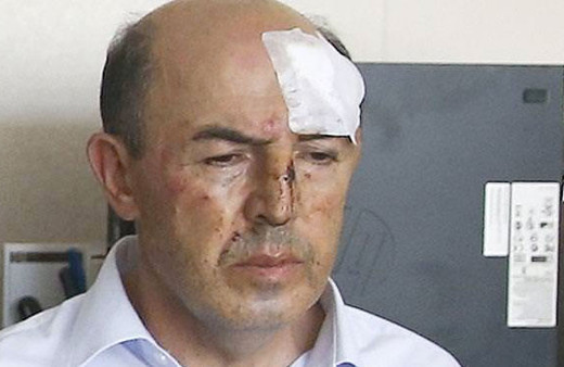 Hakan Fidan'ı görünce ödü kopan FETÖ'cü planı batırmış