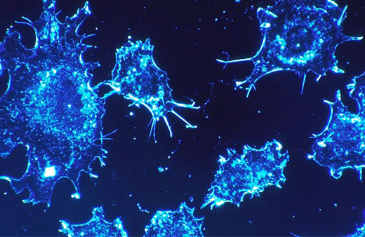 Tümörün vücuttaki yeri, bir damla kanla bulunabilecek