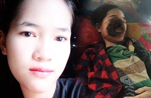 Diş çektirmeye gitti yüzünün yarısını kaybetti inanılmaz olay!