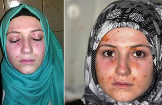 Liseli kızların kavgası bu hale getirdi!