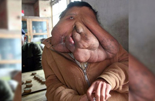 Yüzünü görenler hayret etti öyle bir hastalığı var ki...