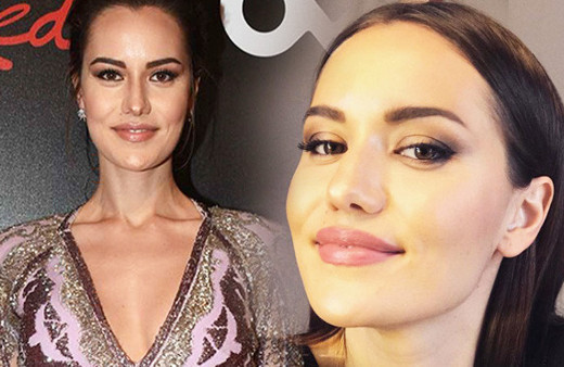 Fahriye Evcen'e neler oluyor? Vücudundaki morluklara bakın!