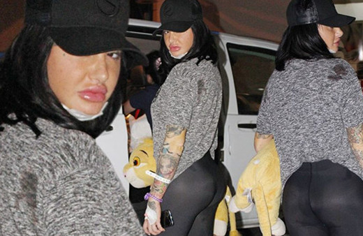 Kalça operasyonu geçirdi, üç hafta oturamayacak!