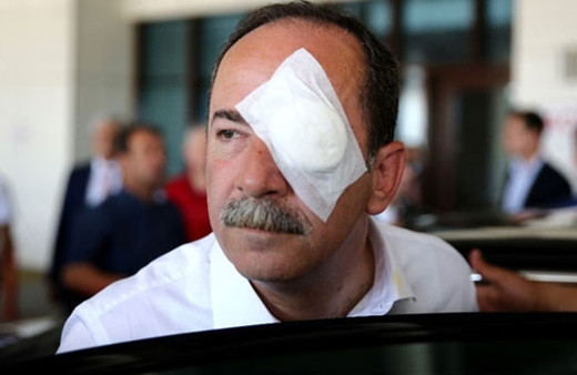 Edirne Belediye Başkanı Recep Gürkan'a saldırı