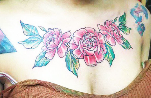 Dövmesini sildirmek isterken başına gelenler korkunç!