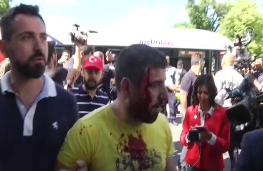 PKK yandaşları Washington'da saldırdı Türk korumalar müdahale etti