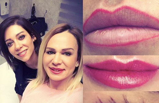 Nagihan Karadere estetiğe doymadı! Öyle bir hale geldi ki...