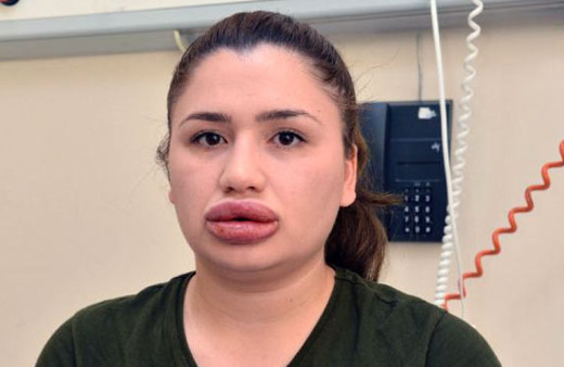 Silikon faciasında yeni gelişme o kuaför bakın ne dedi?