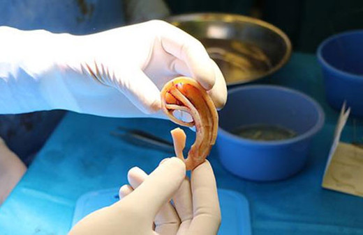 Türk doktor başarısıyla tıp tarihine geçti!