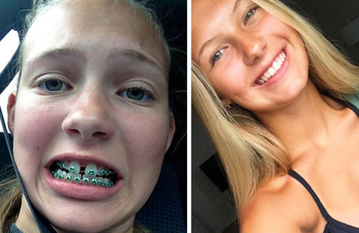 Dişlerini yaptıran insanların muhteşem değişimi