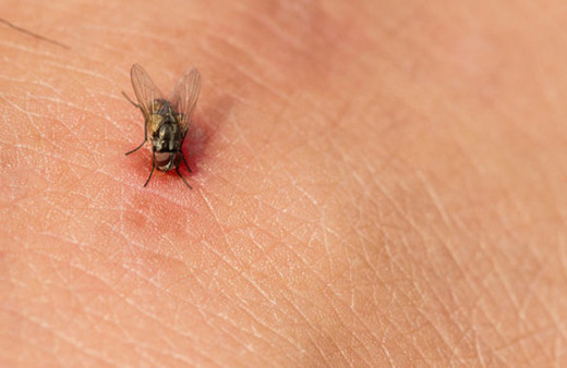 Sinek ısırığı hayatını kararttı