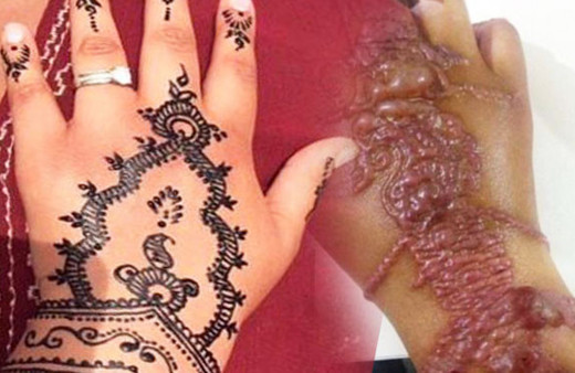 Ellerine dövme yaptırdı ama bu halde geldi korkunç görüntü!