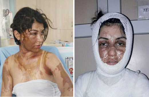 Denizli'de korkunç olay! Uyurken bu hale getirildiler